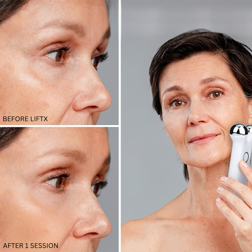 Before and after results for Liorae LiftX