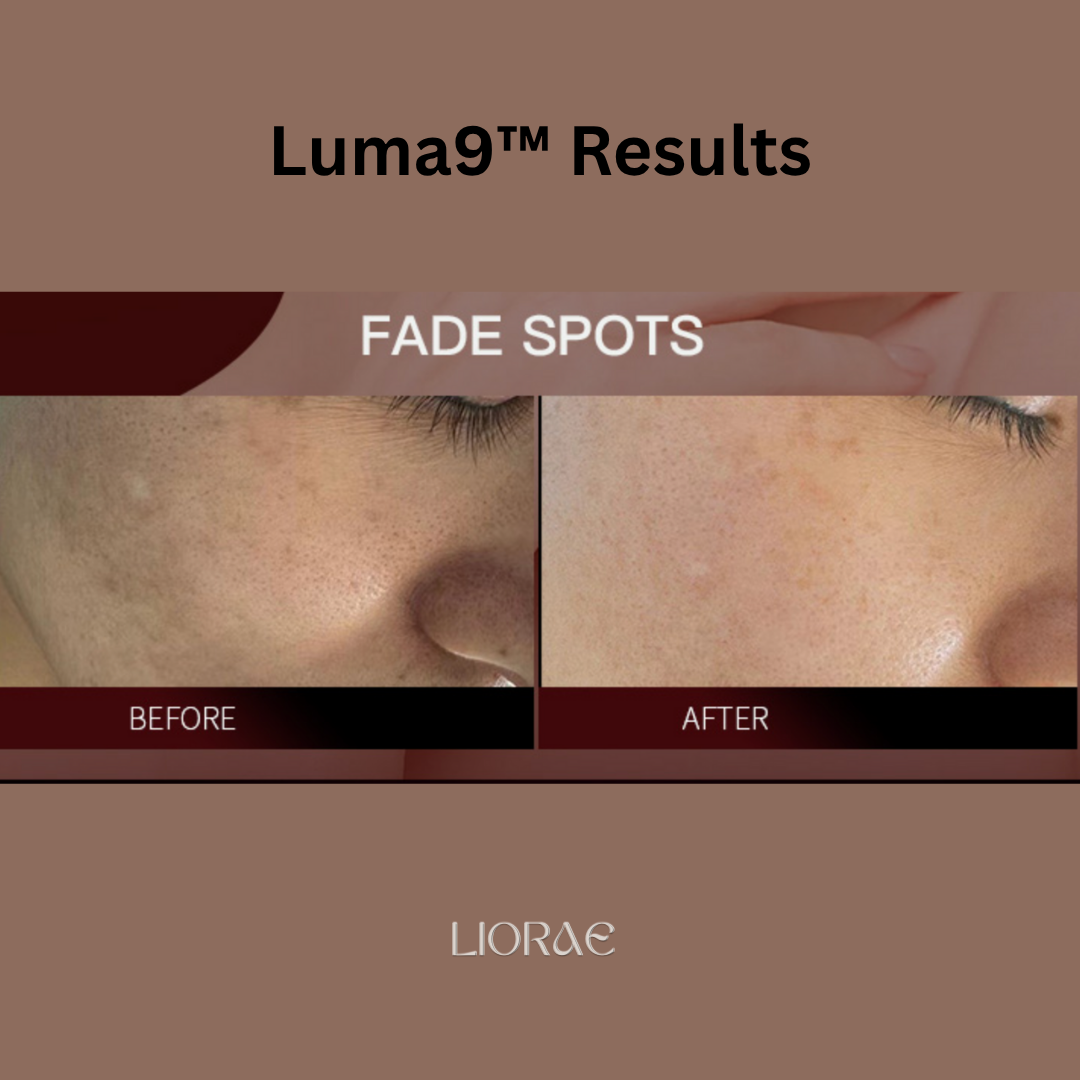 Brightening light therapy using Luma9 mask