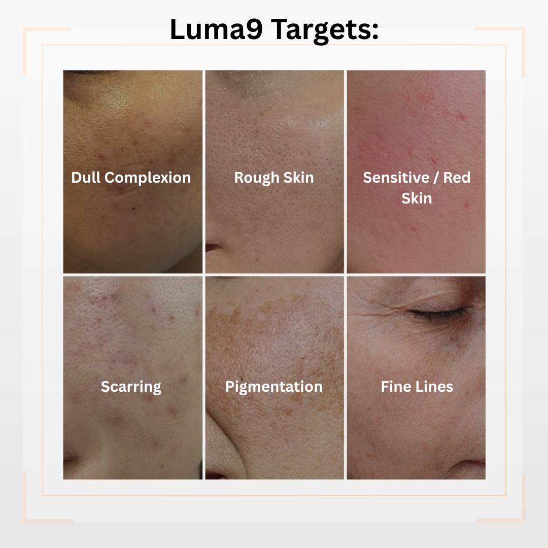 Full-face LED facial mask for skin rejuvenation