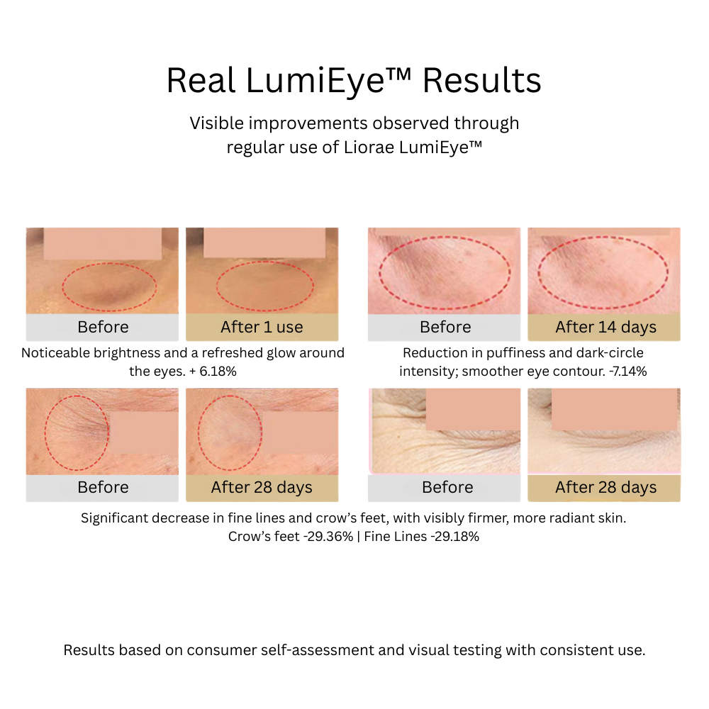Liorae LumiEye™